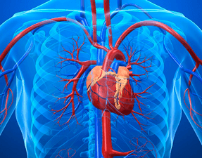 Obstrucciones Arteriales